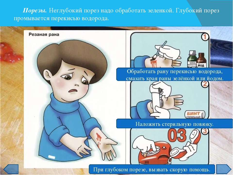 Первая помощь при порезах и ссадинах презентация